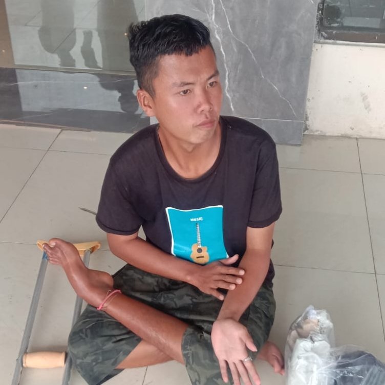 Kefin (23 tahun) remaja tuna grahita yang mengalami cacat kakinya karena kecelakaan beberapa waktu lalu itu butuh solusi konkrit karena seringkali melakukan aksi nekat menghalangi jalan untuk mengemis