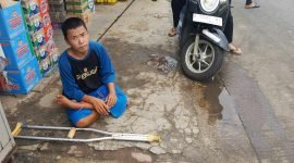 Kefin (23 tahun) Tuna Grahita yang menderita cacat kakinya yang viral sering mangkal ditengah jalan Tapos Tigaraksa (sumber foto ; warga yang peduli dan memindahkan Kefin ke pinggir jalan)